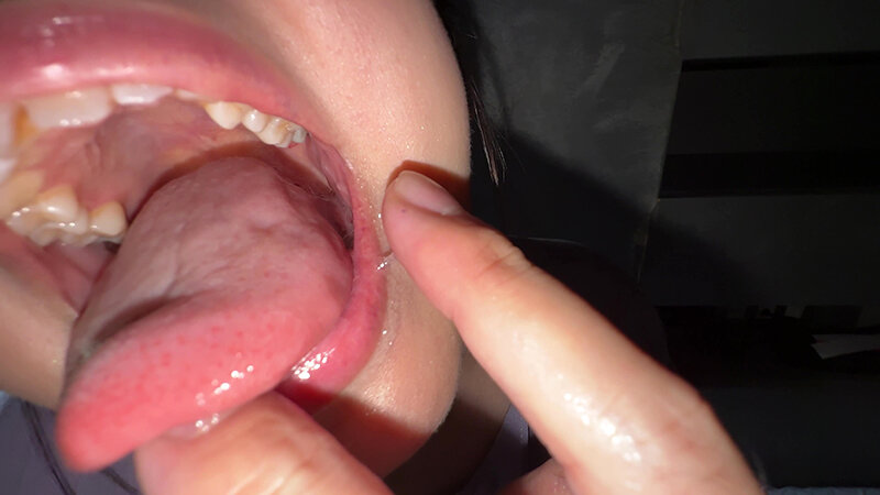 Y-304 第 17 部分 - 30 分钟