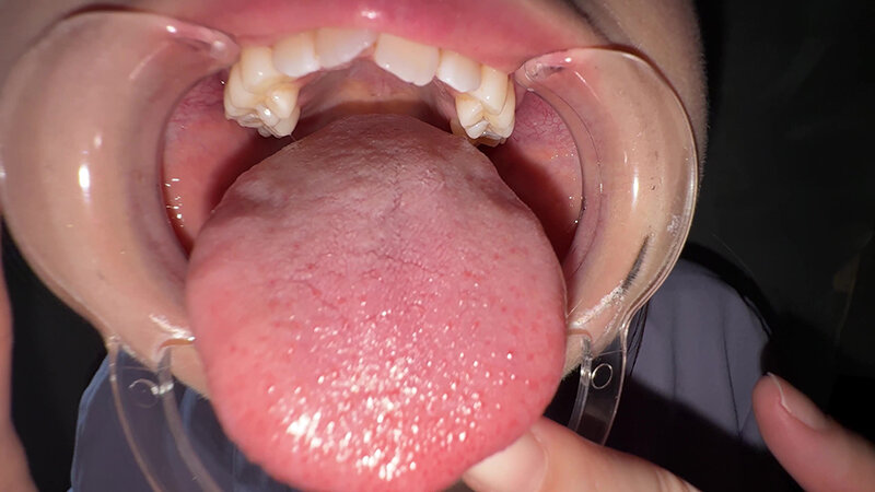 Y-304 第 20 部分 - 30 分钟