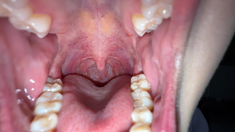 Y-304 第 3 部分 - 30 分钟