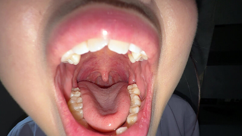 Y-304 第 4 部分 - 30 分钟