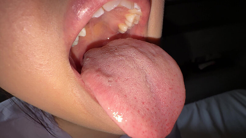 Y-304 第 8 部分 - 30 分钟