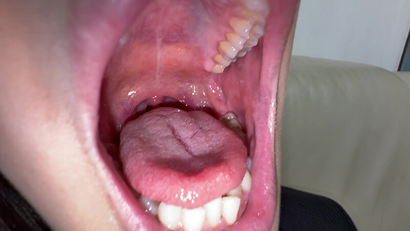 Y-311 Bagian 10 - 30 minit