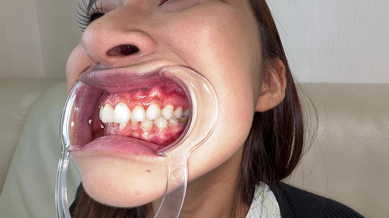 Y-311 Bagian 14 - 30 minit