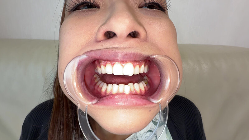 Y-311 Bagian 16 - 30 minit