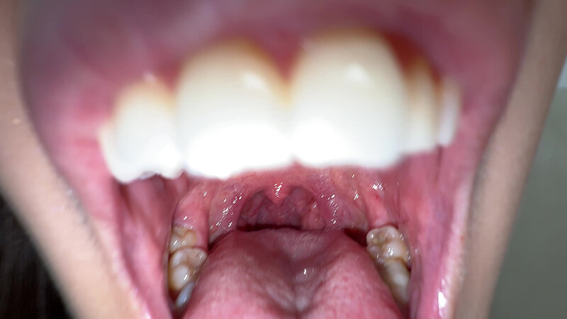 Y-311 Bagian 8 - 30 minit