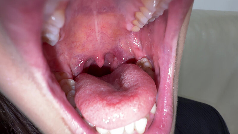 Y-311 Bagian 9 - 30 minit