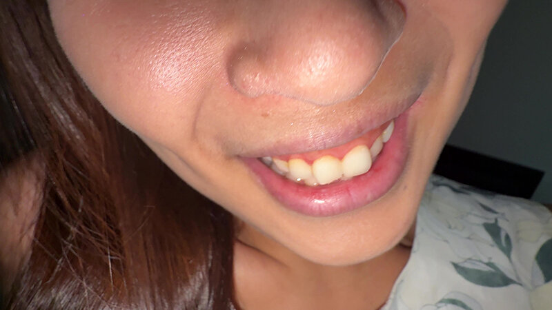 Y-314 Part 1 - 30 minutes