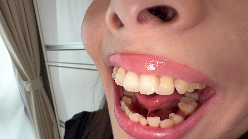 Y-318 Part 2 - 30 minutes