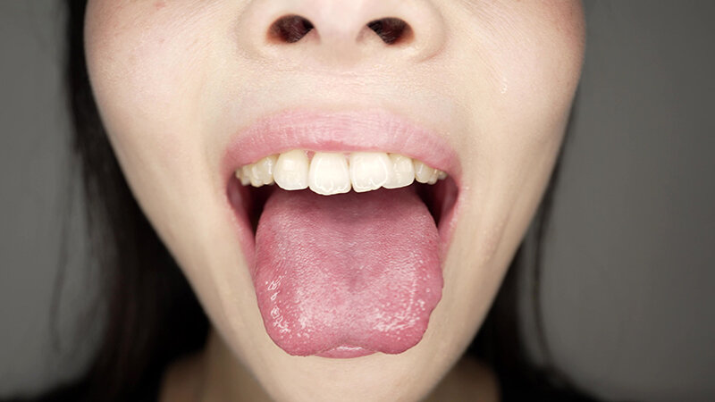 Y-319 パート 15 - 30 分