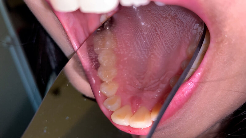 YA-203 Bagian 5 - 34 minit