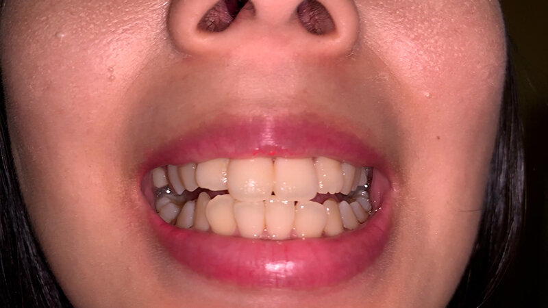 YA-208 パート 7 - 48 分