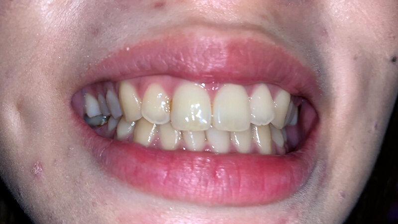 YA-301 Bagian 2 - 31 minit