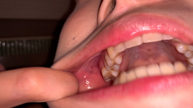 YA-301 Bagian 3 - 32 minit