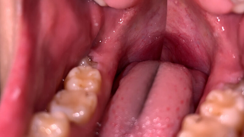 YA-301 Bagian 5 - 34 minit