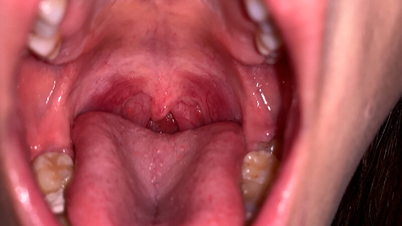 YA-303 パート 5 - 30 分