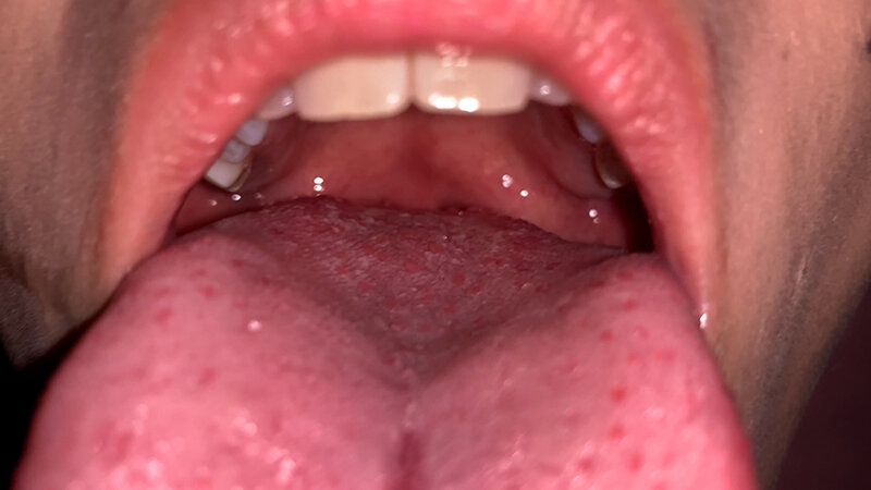 YA-308 Bagian 12 - 63 minit