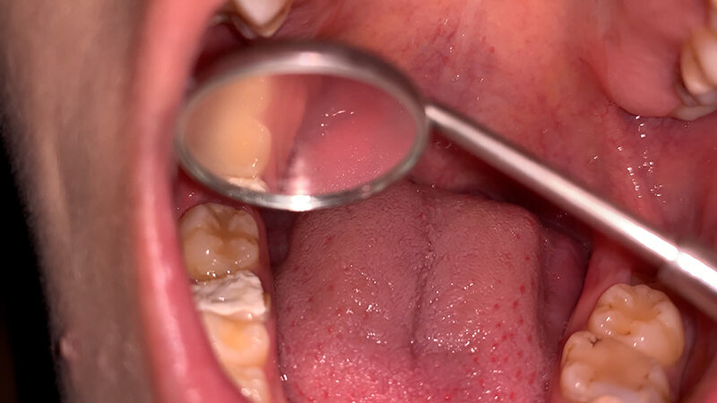 YA-308 パート 3 - 36 分