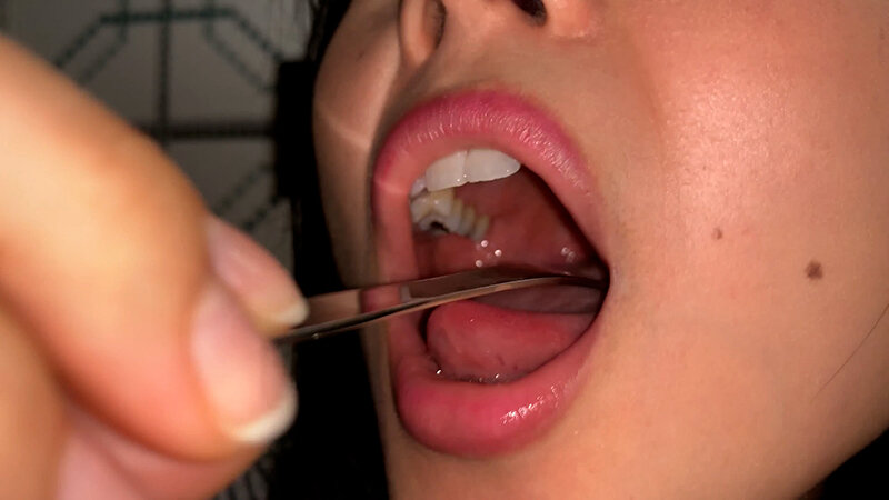 YA-401 Bagian 11 - 30 minit