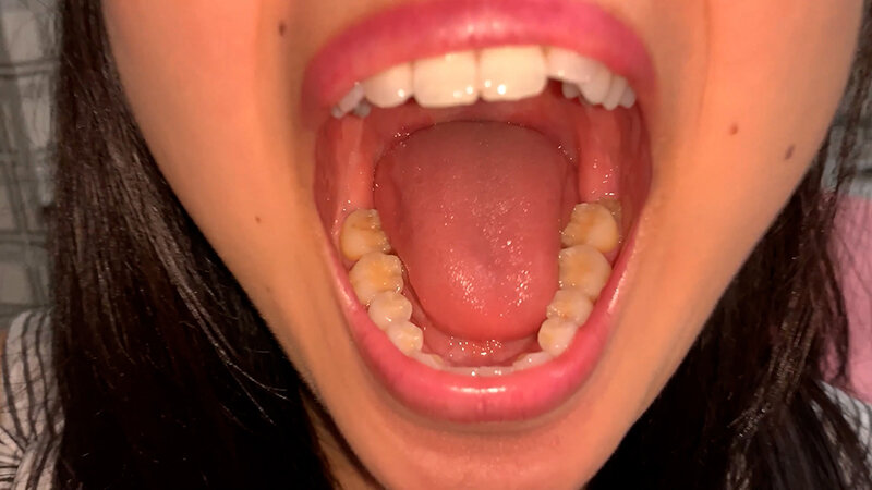 YA-402 Bagian 2 - 31 minit