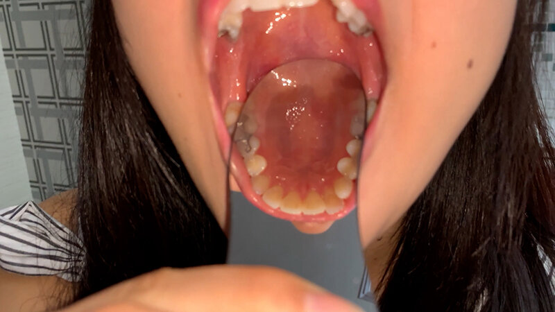 YA-402 Bagian 6 - 35 minit