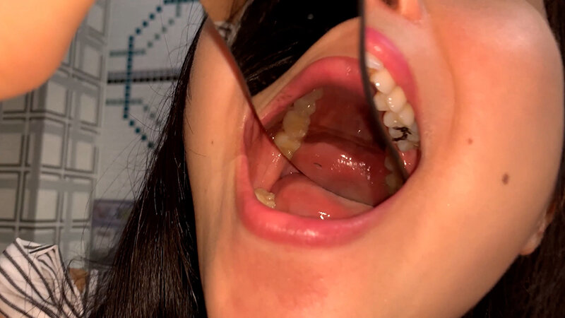 YA-402 Bagian 8 - 37 minit