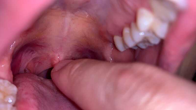 YA-600001 Part 6 - 30 minutes