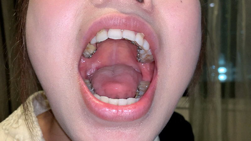 YA-600001 第 2 部分 - 30 分钟