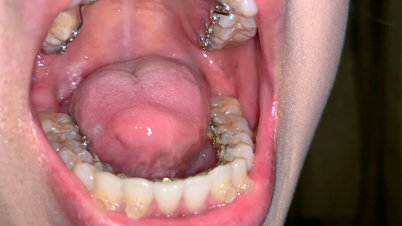 YA-600001 第 4 部分 - 30 分钟