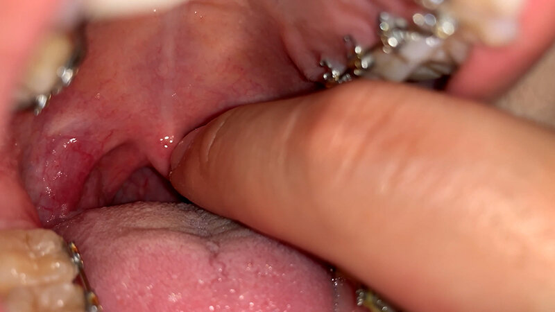 YA-600001 第 7 部分 - 30 分钟