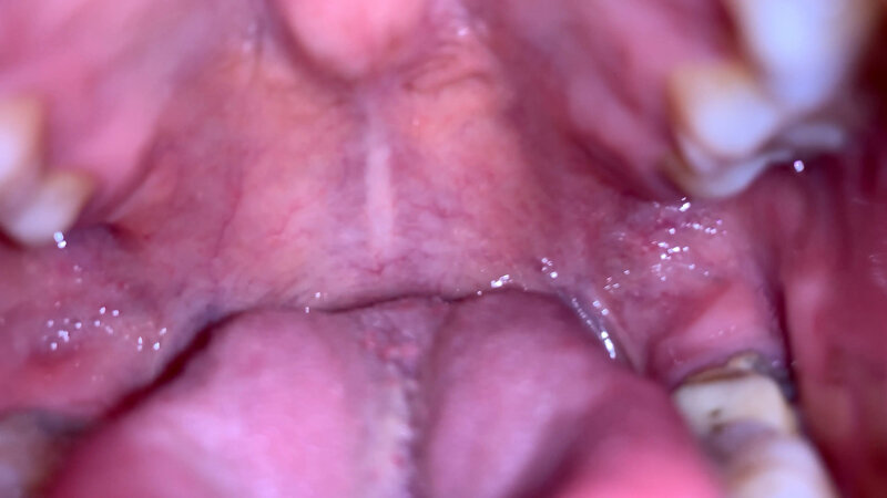 YA-01001 第 12 部分 - 41 分钟