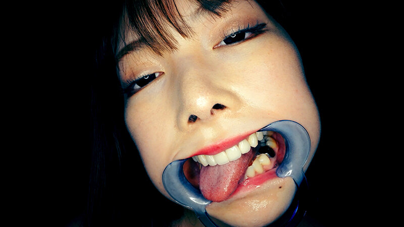 YA-01103 パート 15 - 30 分