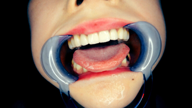 YA-01103 パート 16 - 30 分