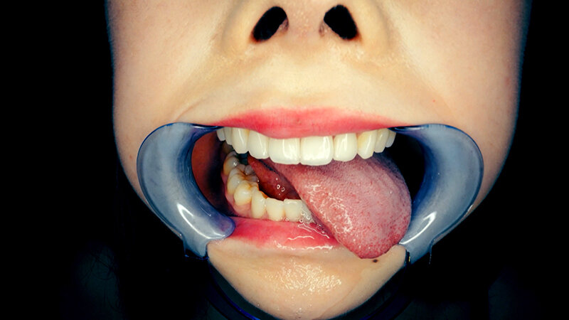 YA-01103 パート 18 - 30 分