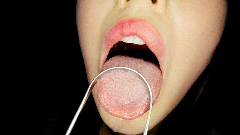 YA-01103 パート 8 - 30 分