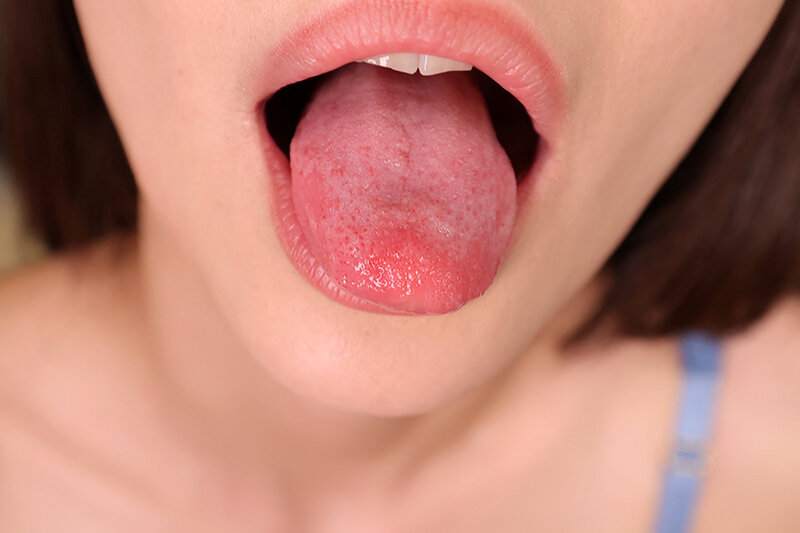 FMDL-003 Bagian 17 - 78 minit