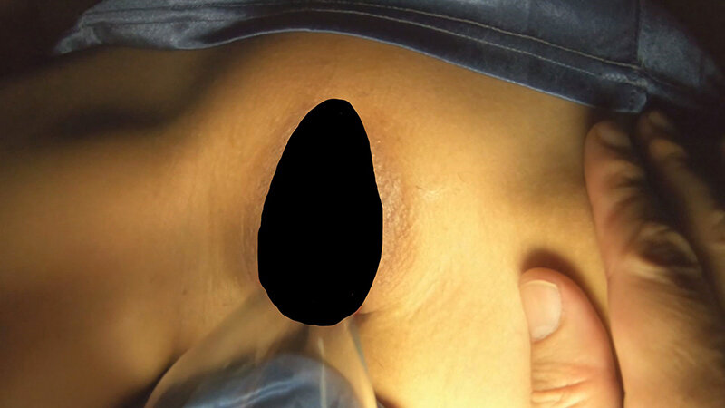 CHU-004 第 6 部分 - 70 分钟