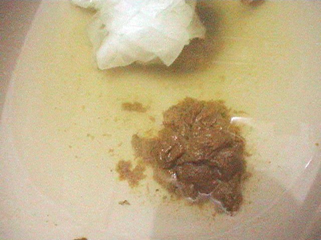 UNKJ-005 第 8 部分 - 156 分钟