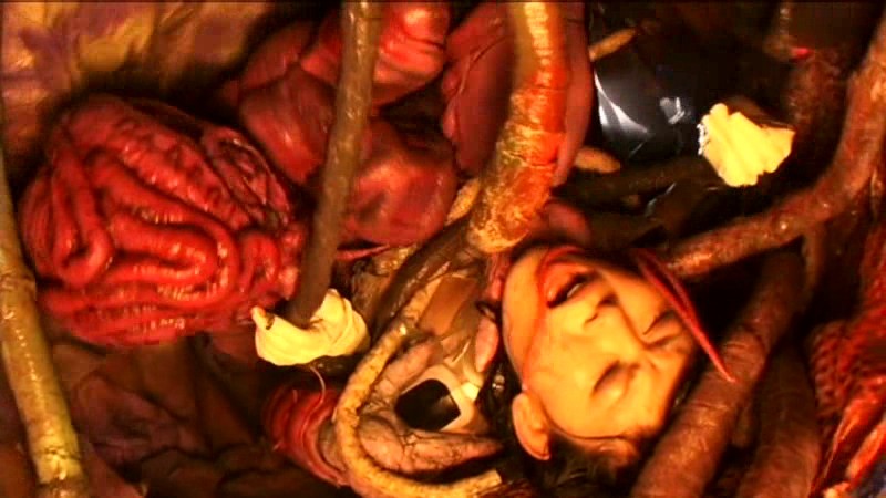 PMID-114 Part 20 - 87 minutes