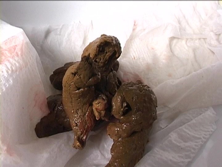 SOG-11 第 8 部分 - 44 分钟