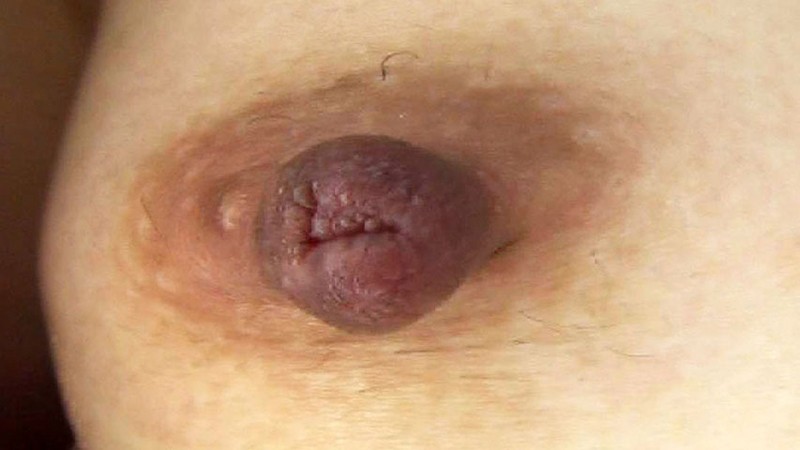 DUP-002 第 18 部分 - 132 分钟