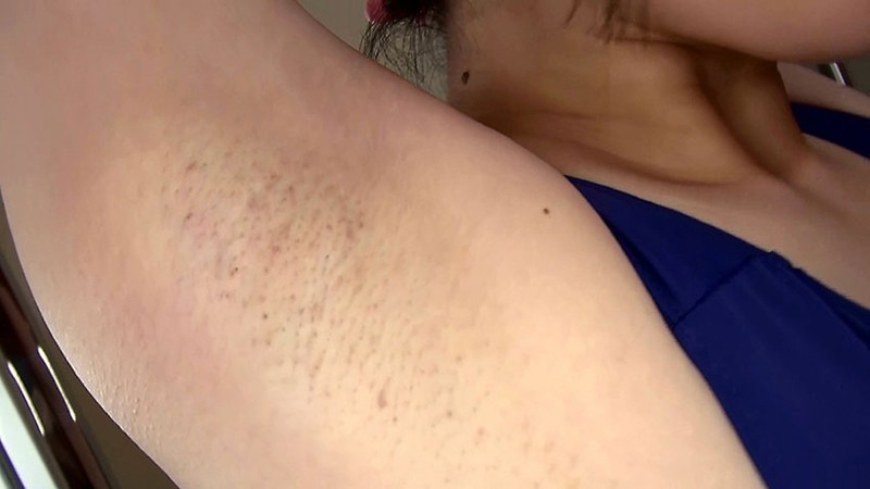 FLB-024 第 9 部分 - 86 分钟