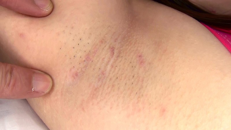 FLB-048 第 9 部分 - 70 分钟