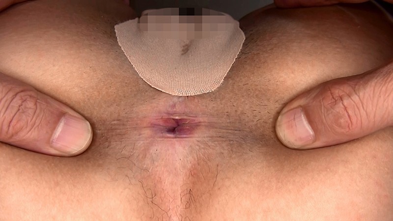 FLB-049 第 17 部分 - 126 分钟