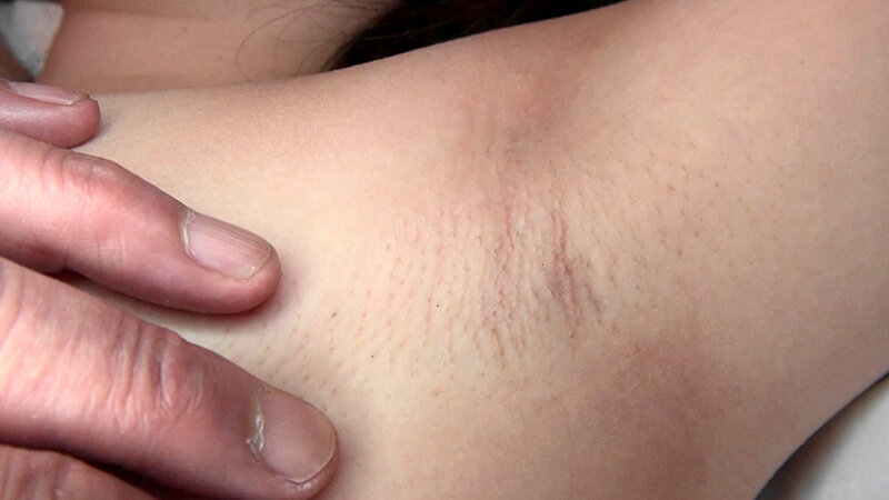 FLB-062 Bagian 19 - 102 minit