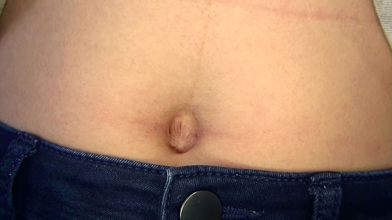 H_NMK-89700025 Part 15 - 100 minutes