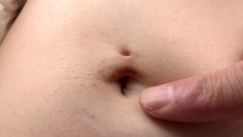 H_NMK-89700025 Part 17 - 110 minutes