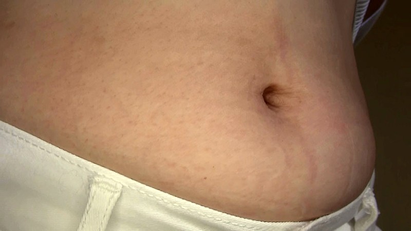 H_NMK-89700025 Part 9 - 70 minutes