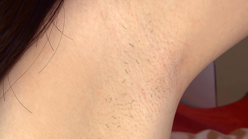 RAM-150 第 2 部分 - 35 分钟