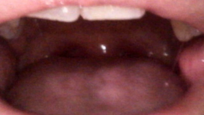 BUG-001 Part 2 - 40 minutes