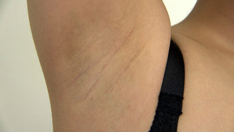 KAGP-381 Bagian 10 - 156 minit